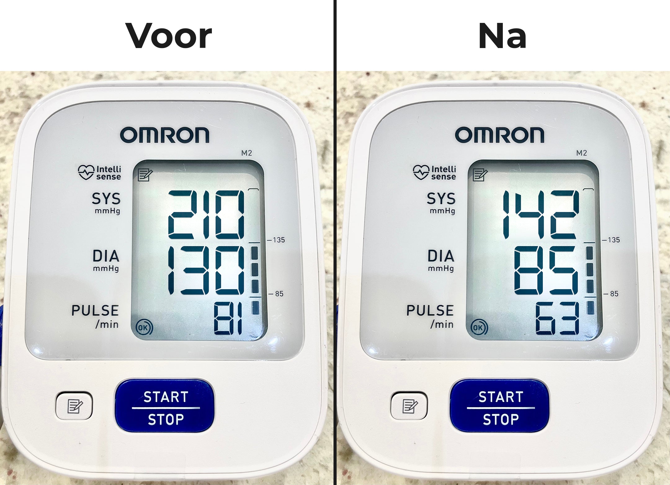 De Stille Doder in Je Slagaders: Hoe Ik Mijn Dodelijk Hoge Bloeddruk Verlaagde Zonder Gevaarlijke Medicatie